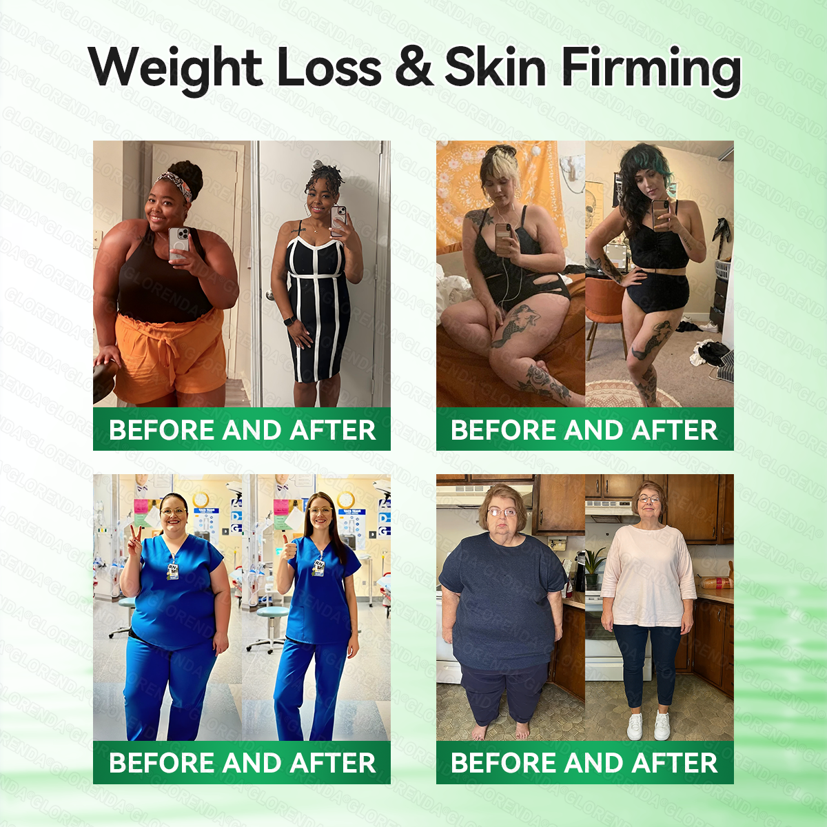 𝑶𝒇𝒇𝒊𝒄𝒊𝒂𝒍 𝑺𝒕𝒐𝒓𝒆  |  🌿𝐆𝐋𝐎𝑹𝑬𝑵𝑫𝗔®𝑴𝒐𝒓𝒊𝒏𝒈𝗮 · 𝗕𝗲𝗿𝗯𝗲𝗿𝙞𝙣𝙚 × 𝙉𝘼𝐃+ 𝟏𝟎-𝐢𝐧-𝟏 𝗔𝗱𝘃𝗮𝗻𝗰𝙚𝙙 𝙉𝙖𝙣𝙤 𝙈𝙞𝙘𝙧𝙤𝙣𝙚𝙚𝐝𝐥𝐞 𝐏𝐚𝐭𝙘𝙝🇺🇸(𝐉𝐮𝐬𝐭 𝐨𝐧𝐜𝐞 𝐚 𝐝𝐚𝐲, 𝐯𝐢𝐬𝐢𝐛𝐥𝐞 𝐜𝐡𝐚𝐧𝐠𝐞𝐬 𝐢𝐧 𝟕 𝐝𝐚𝐲𝐬） ✅ 𝐅𝐨𝐫 𝐨𝐛𝐞𝐬𝐢𝐭𝐲, 🅛🅞🅞🅢🅔 🅢🅚🅘🅝,𝐝𝐢𝐚𝐛𝐞𝐭𝐞𝐬, 𝐬𝐥𝐞𝐞𝐩 𝐚𝐩𝐧𝐞𝐚, 𝐣𝐨𝐢𝐧𝐭 𝐢𝐬𝐬𝐮𝐞𝐬, 𝐚𝐧𝐝 𝐦𝐨𝐫𝐞